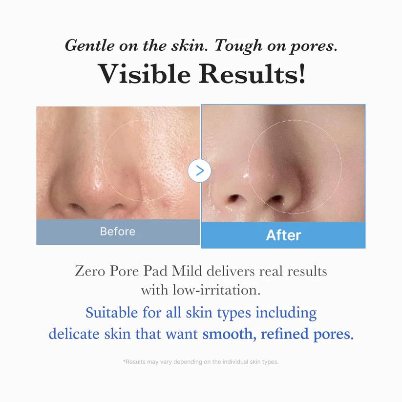 Zero Pore Pad Mild 70 pads