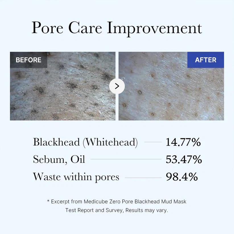 Zero Pore Blackhead Mud Mask 100ml